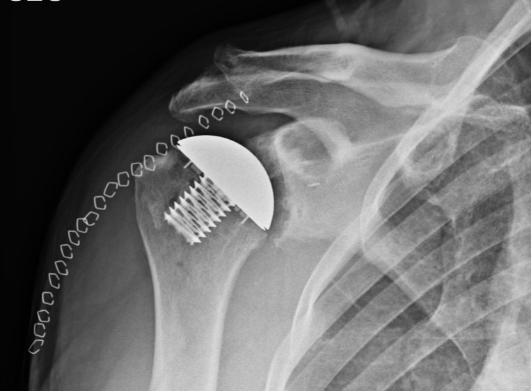 Comeback Champion: David Wesley